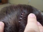 staples